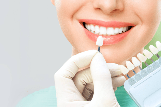 The Impact of Porcelain Veneers on your Smile and Confidence
