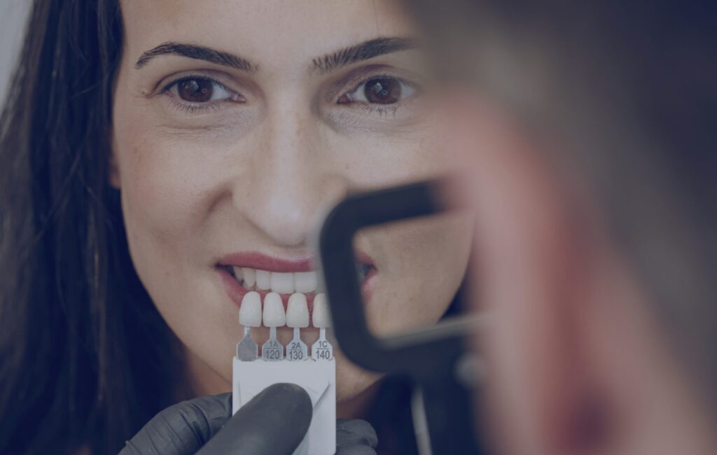 Dental Veneers at Klinika Dental Clinic in Dubai