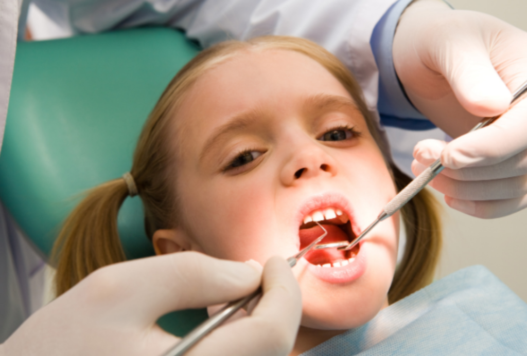 Dental Fillings for Children