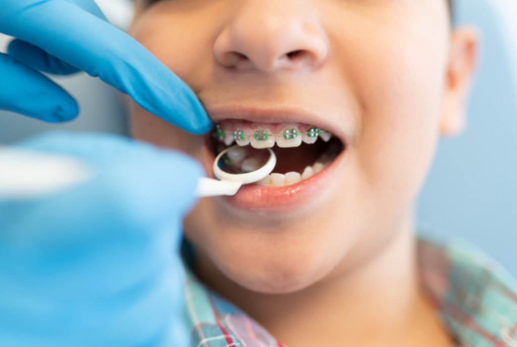 Importance of Orthodontic Adjustment Visits