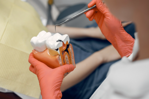 root canal treatments in dubai