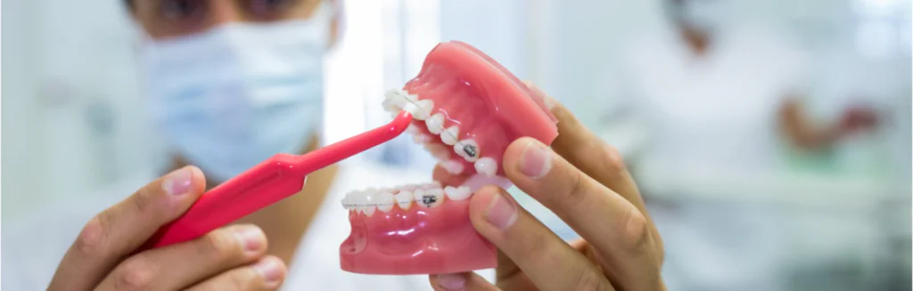 professional teeth cleaning