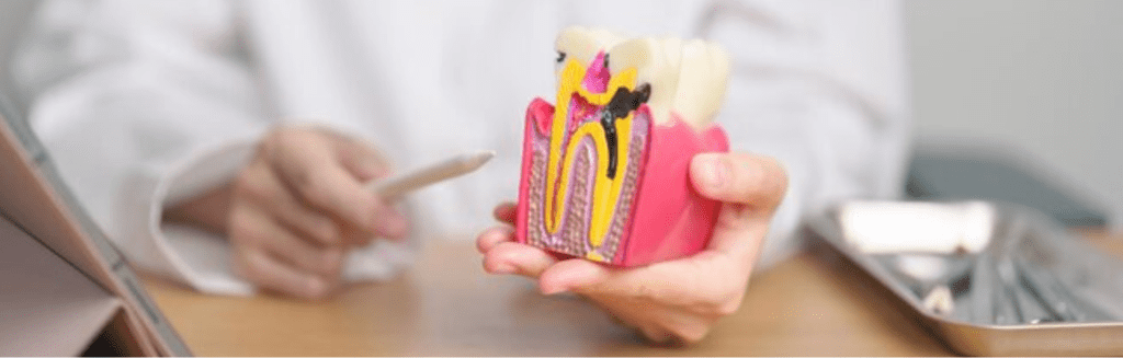Endodontic Treatments in Dubai
