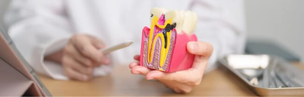 Endodontic Treatments in Dubai