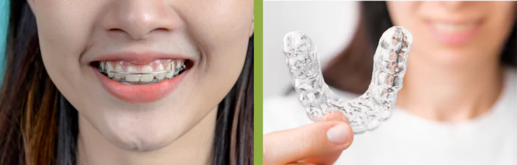 orthodontic treatment in Dubai
