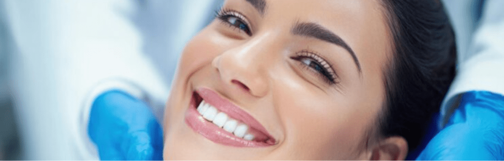 smile makeover